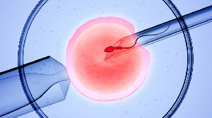 Sperm Ivf