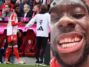 Alphonso Davies Loose Teeth