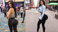 Kim Kardashian 'feki' afariki dunia akifanyiwa upasuaji kuongeza makalio