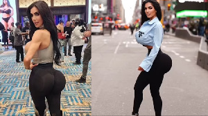 Kim Kardashian 'feki' Afariki Dunia Akifanyiwa Upasuaji Kuongeza Makalio .png