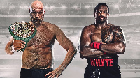 Bondia Tyson Fury Kushoto na Dillian Whyte kulia