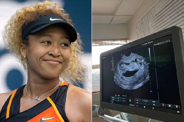 Naomi Osaka