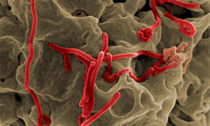 Ebola Virus