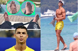 Cx Ronaldo Vidole