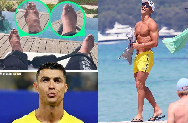 Vidole vya Ronaldo vyazua gumzo