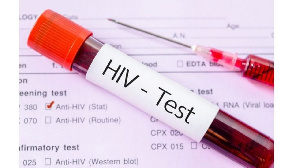 HIV  Test