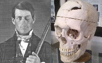 Phineas P. Gage.