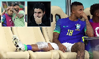 Gabriel Jesus aliumia katika mchezo dhidi ya Cameroon