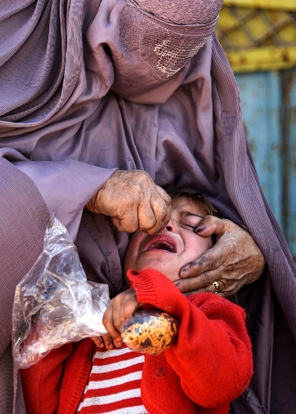 Sudani Kusini yatokomeza polio