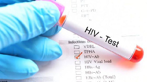 HIV TEST.jpeg