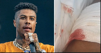 Blueface anusurika kuuawa kwa kuchomwa kisu